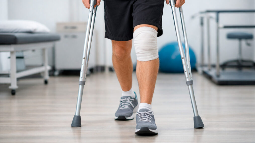 paciente andando com muletas após cirurgia de LCA